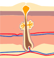 L&rsquo;acn&eacute;