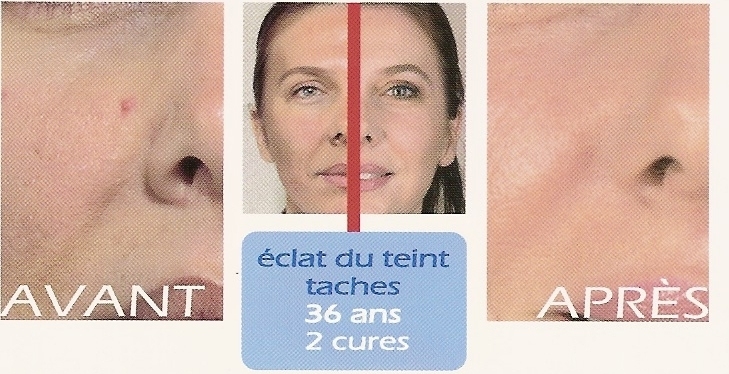 éclat du teint éclat du teint